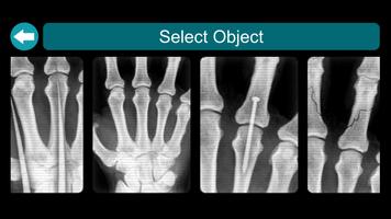 X-Ray Scanner capture d'écran 2