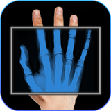 X-Ray Filter Photo APK