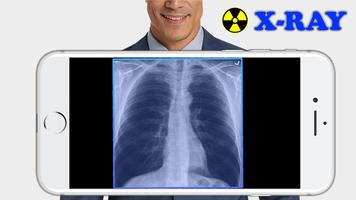 X-Ray Filter Photo โปสเตอร์