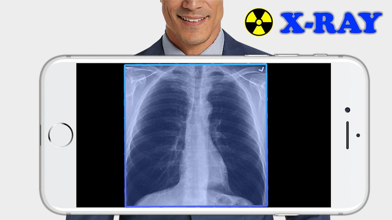 X-Ray Filter Photo poster