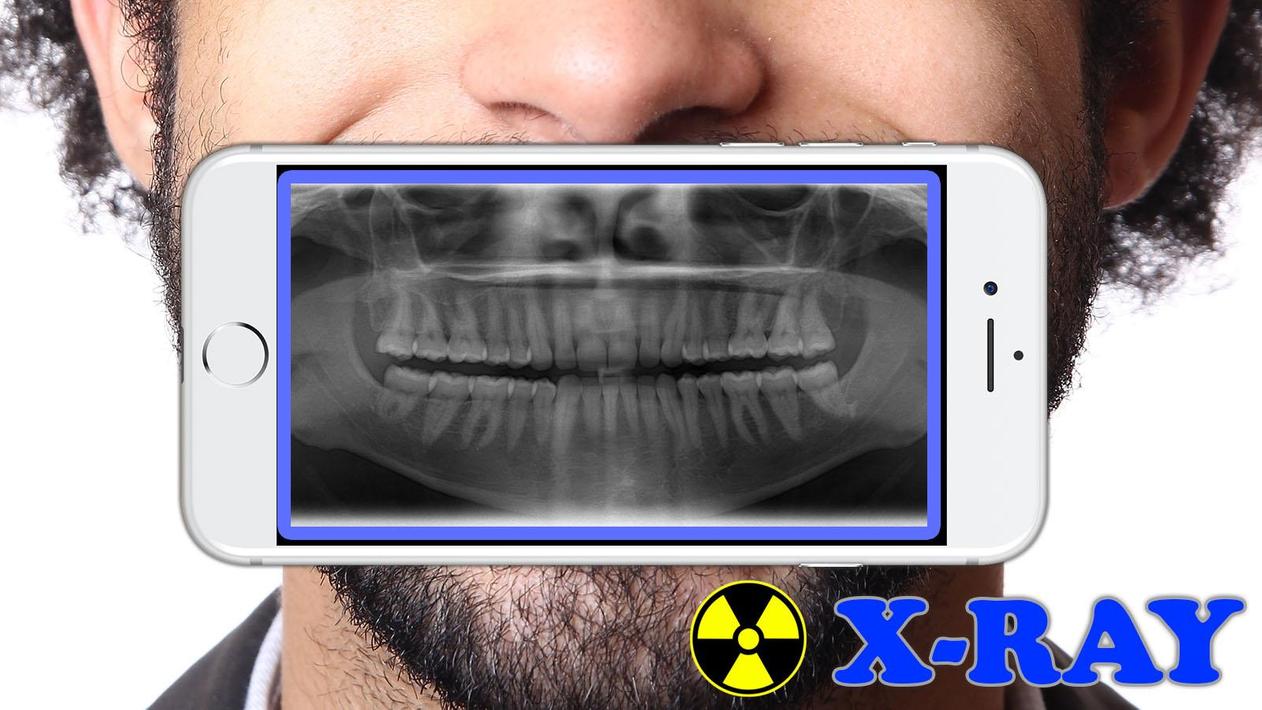 X-Ray Filter Photo screenshot 4