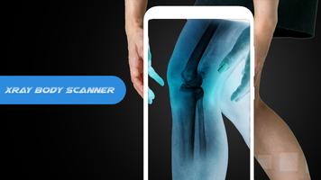 X ray Body Scanner Xray camera imagem de tela 3