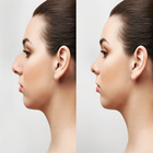 تصغير الانف بدون عمليات تجميل icon