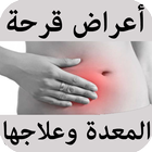 أعراض قرحة المعدة وعلاجها Zeichen