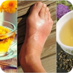Các biện pháp khắc phục axit u