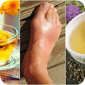 Uric acid tips