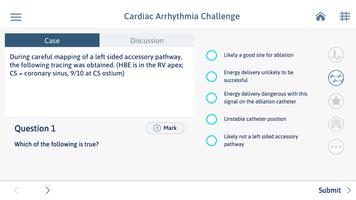 1 Schermata Cardiac Arrhythmia Challenge