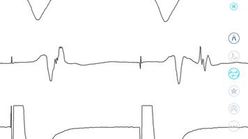 3 Schermata Cardiac Arrhythmia Challenge