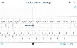 Cardiac Device Challenge Screenshot 1