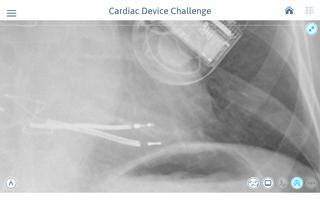 برنامه‌نما Cardiac Device Challenge عکس از صفحه