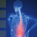 Back Pain & How To Prevent It APK