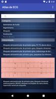 Atlas de ECG screenshot 1