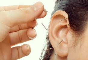 3 Schermata Acupuncture
