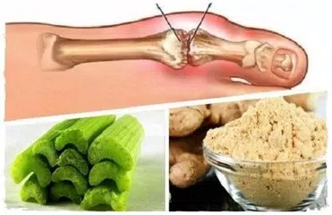 download Home rimedi gotta dell'acido urico APK