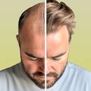 HairCode·Hair Loss Analysis AI APK
