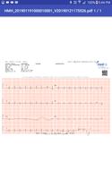 AIIMS ECG Viewer screenshot 1