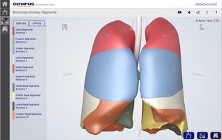 BronchoGuide capture d'écran 3