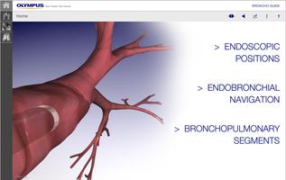 BronchoGuide پوسٹر