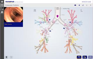 BronchoGuide ภาพหน้าจอ 1