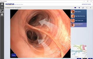 BronchoGuide ภาพหน้าจอ 2