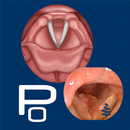 Polyps APK
