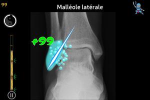 Anatomy Ninja Lower Limb capture d'écran 1