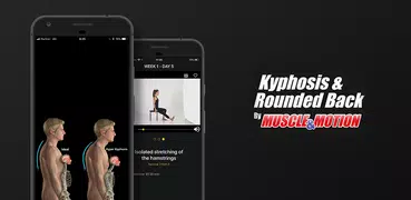 Kyphosis & Rounded Back by M&M