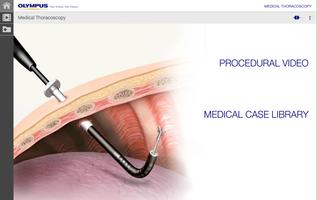 Medical Thoracoscopy 포스터