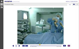 برنامه‌نما Medical Thoracoscopy عکس از صفحه