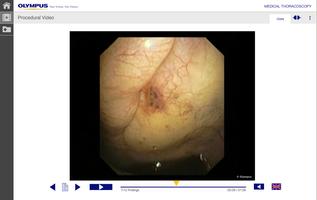 Medical Thoracoscopy скриншот 3