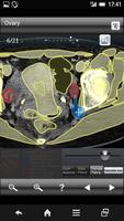 2 Schermata AbdominalCTSectionalWalkerLite