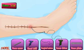 Dokter Tom Leg Bedah Permainan screenshot 2