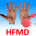 HFMD Info