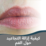 كيفية إزالة التجاعيد حول الفم