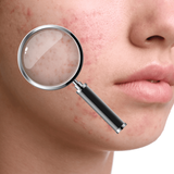 SkinScan AI: Face & Mole Check APK