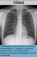 Radiografías screenshot 2