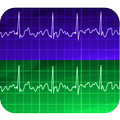 Electrocardiogram