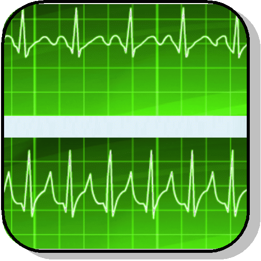 Electrocardiograma