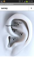 Ear Acupuncture تصوير الشاشة 2