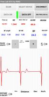 Free Lab ECG Poster