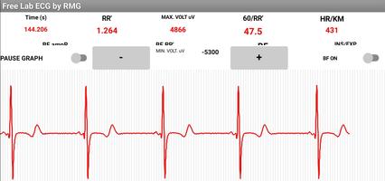 Free Lab ECG captura de pantalla 1