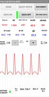 Free Lab ECG captura de pantalla 2