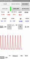 Free Lab ECG captura de pantalla 3