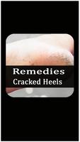 Remedies for cracked heels Affiche