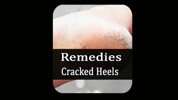 Remedies for cracked heels تصوير الشاشة 1