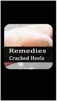 Remedies for cracked heels ảnh chụp màn hình 2