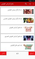 علاج أمراض القولون Affiche