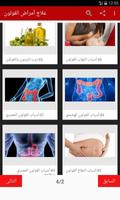 علاج أمراض القولون ảnh chụp màn hình 1