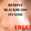 Remove Blackheads On Nose