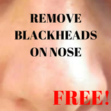 Remove Blackheads On Nose icon
